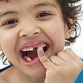 tooth surgery